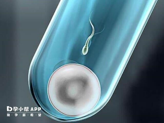 成都试管婴儿