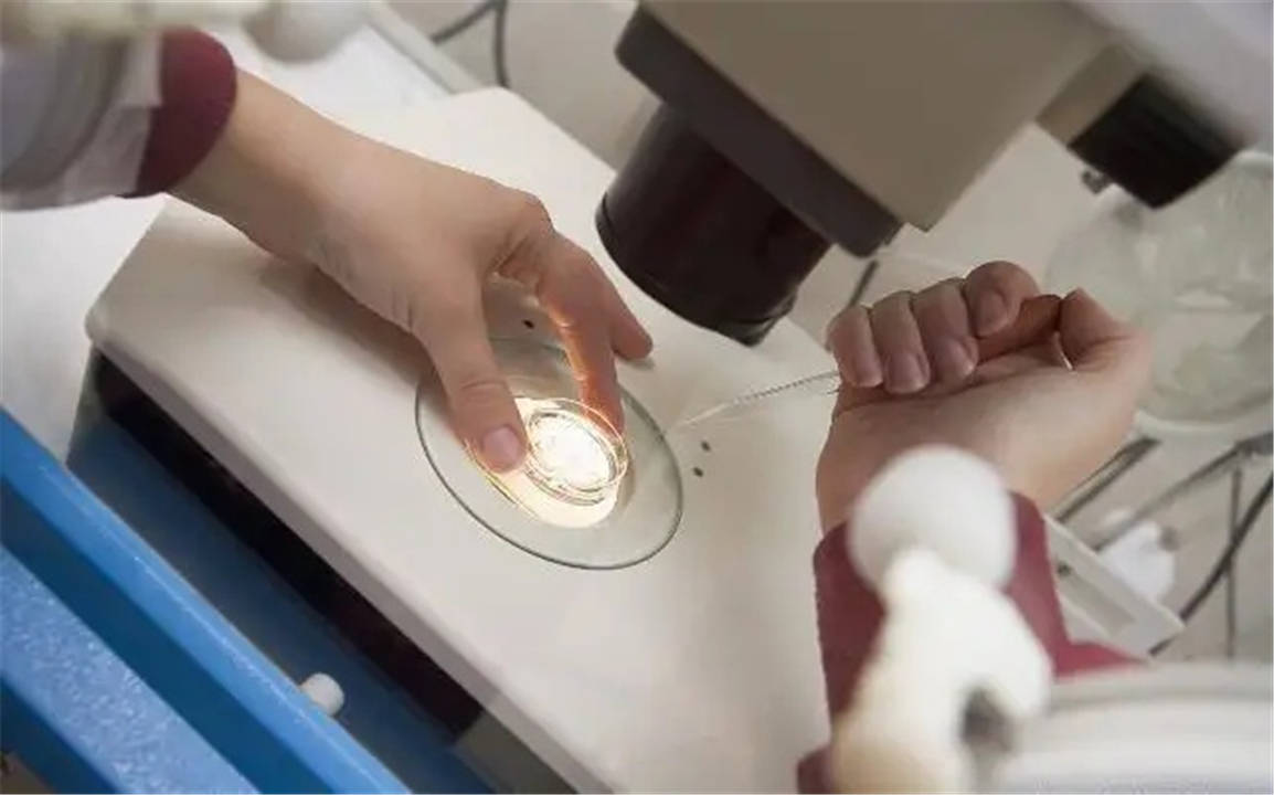 成都试管婴儿
