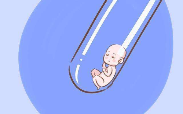 人流手术