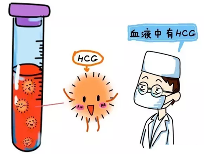 人流手术