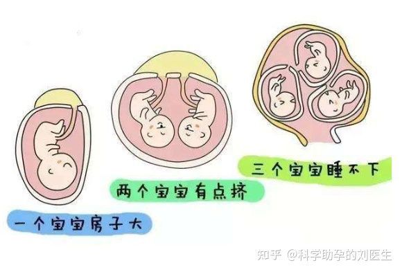 人流手术
