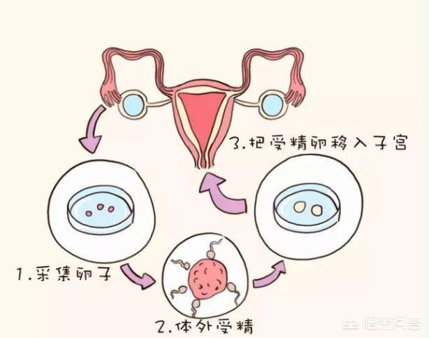 人流手术